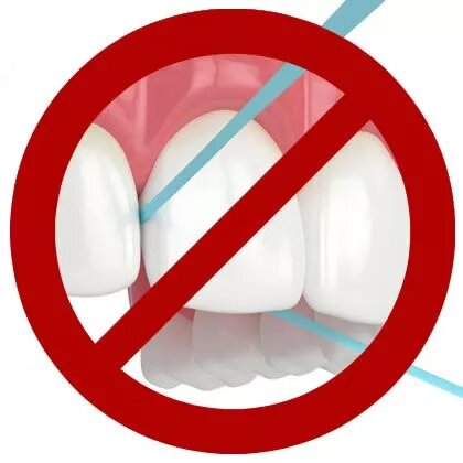 9 Reasons Not to Floss Your Teeth (or Use Other Interdental Cleaners)